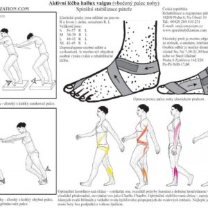 Korrektor Hallux Valgus von Smisek
