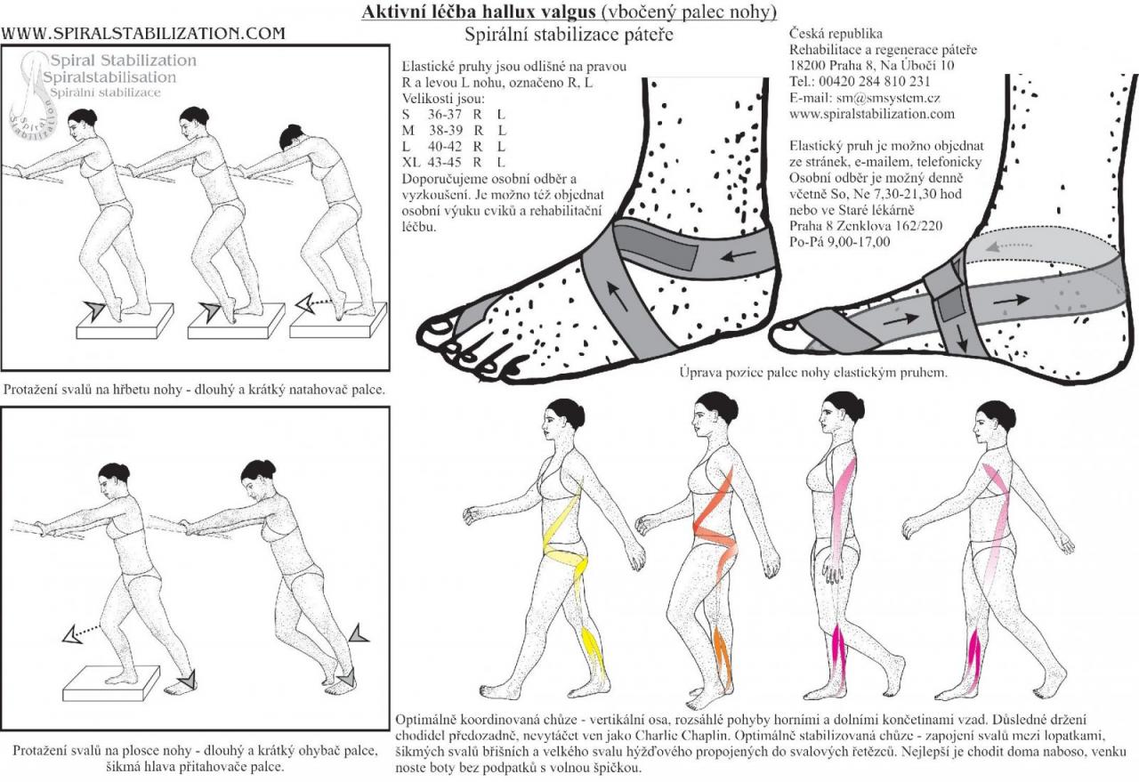Korrektor Hallux Valgus von Smisek